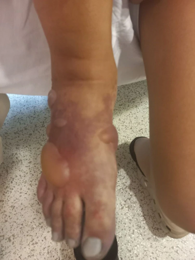 Девочка-подросток осталась без ноги. Ее мама винит врачей (фото, видео)