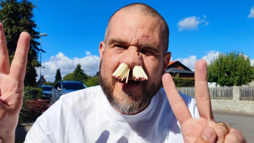 Мужчина из Швеции засунул себе в нос 81 спичку и попал в Книгу рекордов Гиннесса