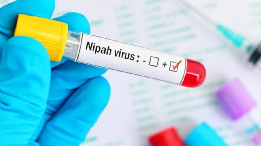 Вирус Nipah: на границах Кыргызстана ввели усиленные меры инфекционной безопасности