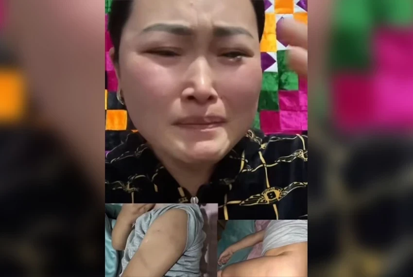 В Караколе расследуют появление синяков у трехлетнего мальчика в детсаду